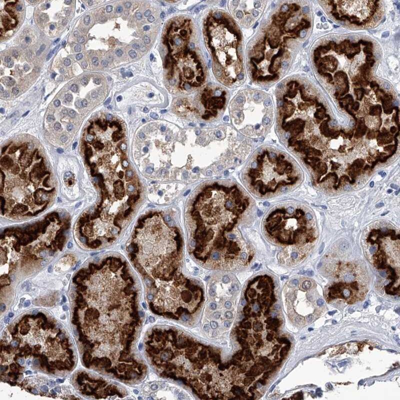 <b>Independent Antibodies Validation. </b>Staining of human kidney shows strong cytoplasmic and membranous positivity in tubular cells.