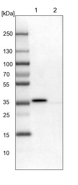 Lane 1: NIH-3T3 cell lysate (Mouse embryonic fibroblast cells)Lane 2: NBT-II cell lysate (Rat Wistar bladder tumour cells)