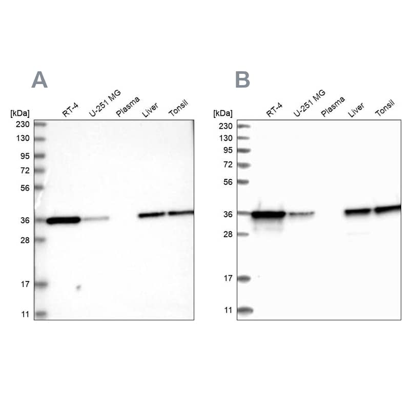 <b>Independent Antibodies Validation. </b>Analysis using Anti-PDXK antibody NBP1-88283 (A) shows similar pattern to independent antibody NBP1-88284 (B).