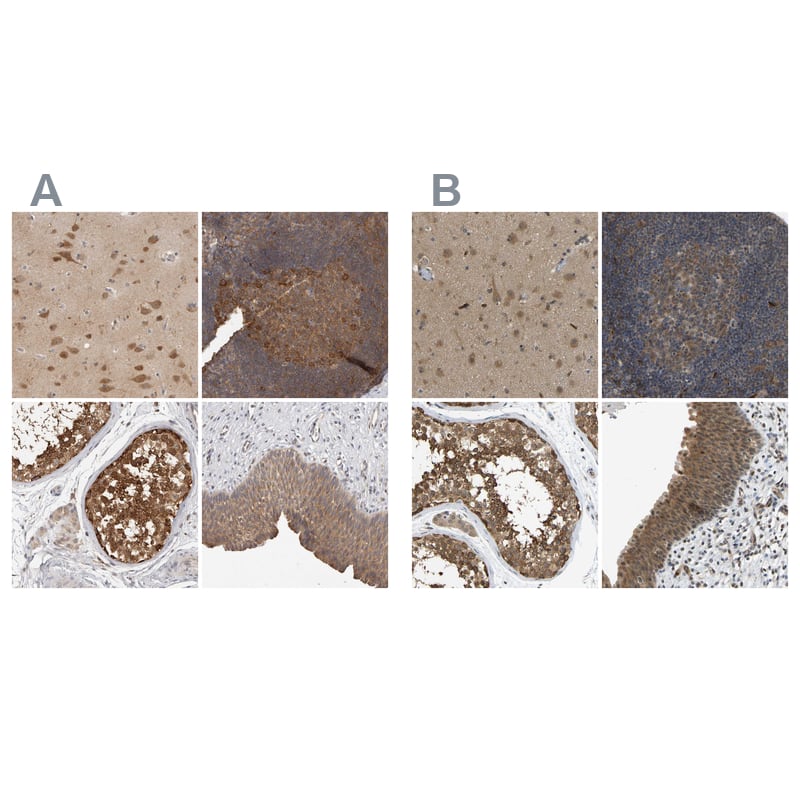<b>Orthogonal Strategies Validation. </b>Staining of human cerebral cortex, lymph node, testis and urinary bladder HPA029426 (A) shows similar protein distribution across tissues to independent antibody HPA018520 (B).
