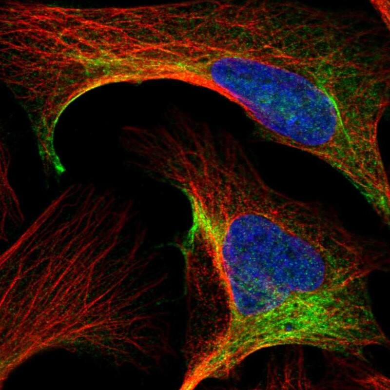 Staining of human cell line U-2 OS shows localization to intermediate filaments.
