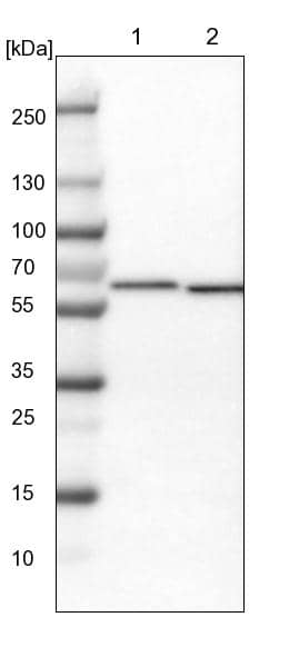 Western Blot CCT8 Antibody - BSA Free