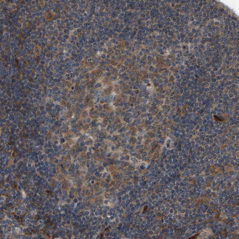 Immunohistochemistry-Paraffin CCT8 Antibody - BSA Free