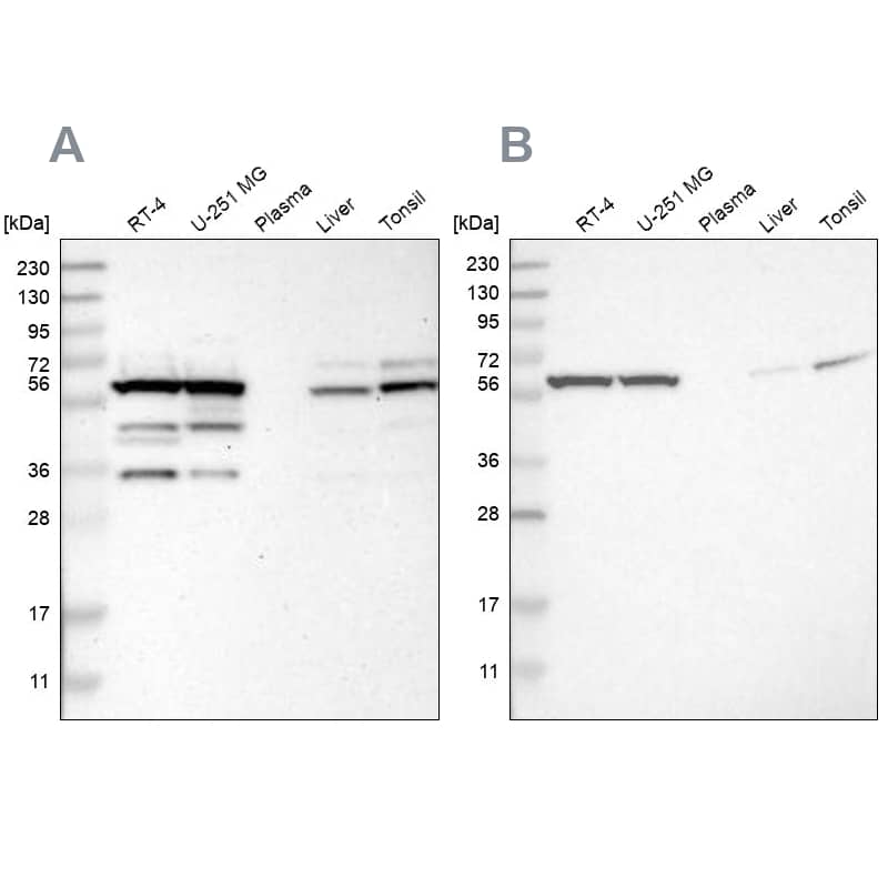 Western Blot CCT8 Antibody - BSA Free