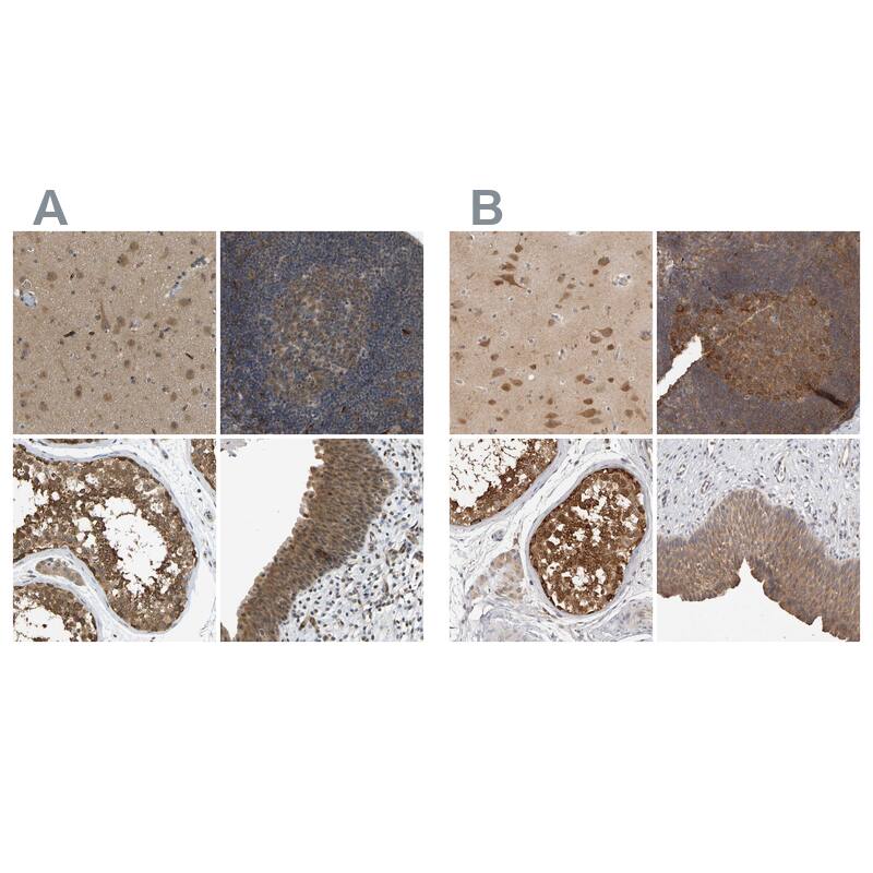 Immunohistochemistry-Paraffin CCT8 Antibody - BSA Free