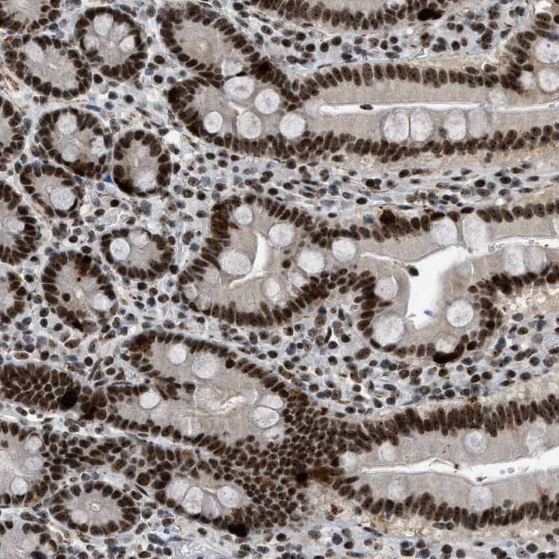 Staining of human duodenum shows strong nuclear positivity in glandular cells.