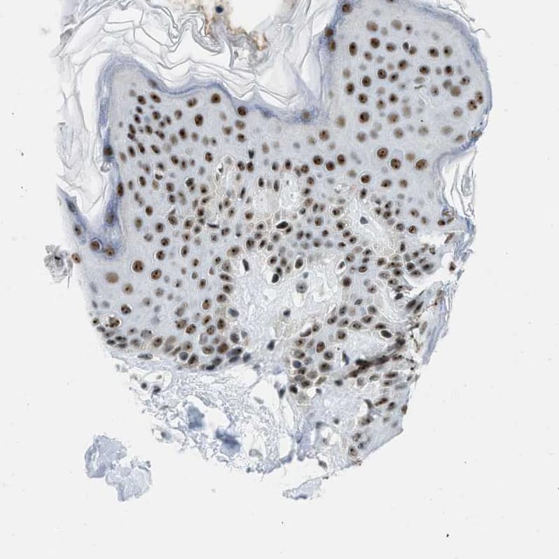 Staining of human skin shows strong positivity in nucleoli and nucleus in squamous epithelial cells.