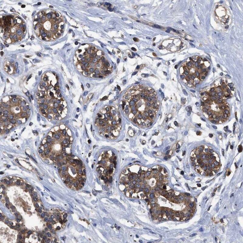 Immunohistochemistry-Paraffin LRRC3 Antibody - BSA Free