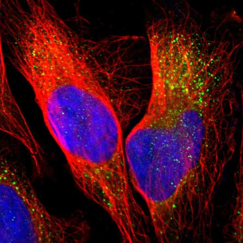 Immunocytochemistry/ Immunofluorescence PANK2 Antibody - BSA Free