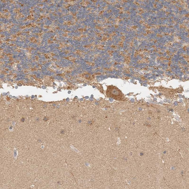 Immunohistochemistry-Paraffin ITPA Antibody - BSA Free