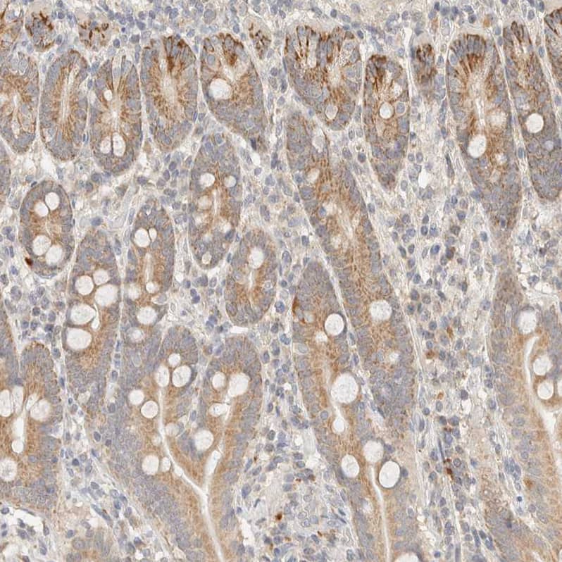 Immunohistochemistry-Paraffin ITPA Antibody - BSA Free