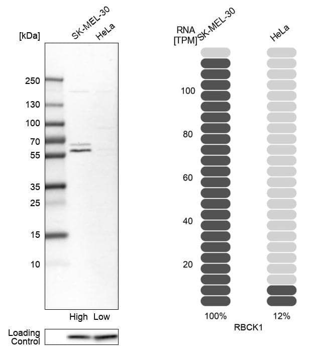 Western Blot RBCK1 Antibody - BSA Free