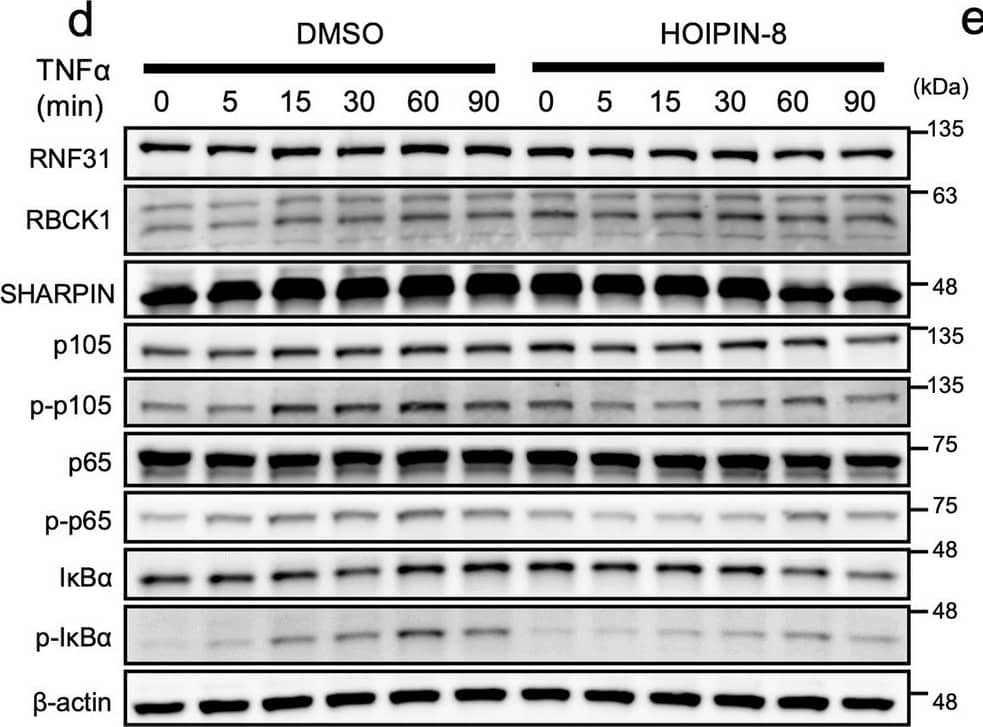 Inhibition of RNF31 with HOIPIN-8 decreases proliferation, invasion, and NF-kappa B activation in HCC cell lines. (a) Cell proliferation was evaluated in HepG2 and Hep3B cells treated with 100 uM HOIPIN-8. (b) Invasion was evaluated in HepG2 and Hep3B cells in the presence of 10 or 30 uM HOIPIN-8. Representative images of invading cells are shown in the right panel. Cell nuclei are stained in purple. (c) Expression of NF-kappa B target genes in HepG2 and Hep3B cells was evaluated by qPCR. Cells were pretreated with 30 uM HOIPIN-8 for 1 h, followed by stimulation with 10 ng/mL TNF-alpha  for 2 h. (d) Phosphorylation of NF-kappa B signaling factors upon TNF-alpha  stimulation was evaluated in HepG2 cells with or without 30 uM HOIPIN-8. Cell lysates were immunoblotted by the indicated antibodies. (e) Effect of HOIPIN-8 on TNF-alpha  + CHX-mediated apoptosis in HepG2 and Hep3B cells. Cells were pre-treated with HOIPIN-8 for 1 h and then stimulated with 40 ng/mL TNF-alpha  and 20 ug/mL CHX for 0, 4, and 8 h, and cell lysates were immunoblotted by the indicated antibodies. *P < 0.05; n.s., not significant; Cas-3, caspase-3; cl-Cas-3, cleaved caspase-3; CHX, cycloheximide. Image collected and cropped by CiteAb from the following open publication (//www.nature.com/articles/s41598-023-50594-3), licensed under a CC-BY license. Not internally tested by Novus Biologicals.