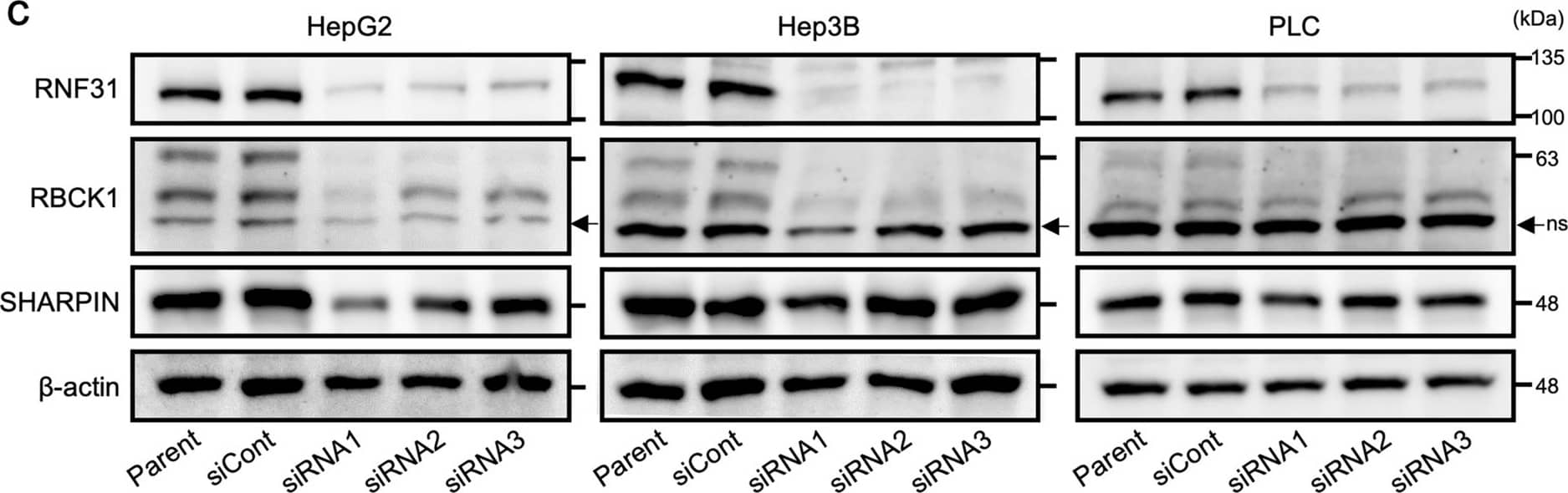 Expression of RNF31 in HCC cell lines and evaluation of RNF31 knockdown. (a) The mRNA level of RNF31 was evaluated in the HepG2, Hep3B, PLC, Huh7, HLE, and HLF cell lines by qPCR. mRNA level of RNF31 in Huh7 cells was used as reference. (b) The protein expression levels of RNF31, RBCK1, and SHARPIN were evaluated by Western blotting. (c) The effect of RNF31 knockdown was evaluated using Western blotting for HepG2, Hep3B, and PLC cells transfected with control (siCont) and RNF31-specific siRNAs (siRNA1-3). For quantification, normalized RNF31/b-actin level in parental cells was used as reference. d. The effect of RNF31 knockdown was evaluated using qPCRs. mRNA level of RNF31/GAPDH in control cells was used as reference. *P < 0.05; ns, non-specific; n.s., not significant; siCont, control siRNA. Image collected and cropped by CiteAb from the following open publication (//www.nature.com/articles/s41598-023-50594-3), licensed under a CC-BY license. Not internally tested by Novus Biologicals.
