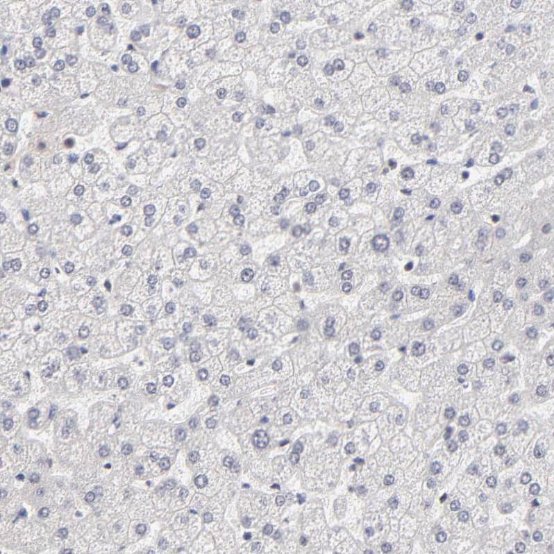 Staining of human liver shows no positivity in hepatocytes as expected.