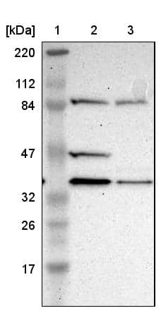 Lane 1: Marker [kDa] 220, 112, 84, 47, 32, 26, 17Lane 2: Human cell line RT-4Lane 3: Human cell line U-251MG sp