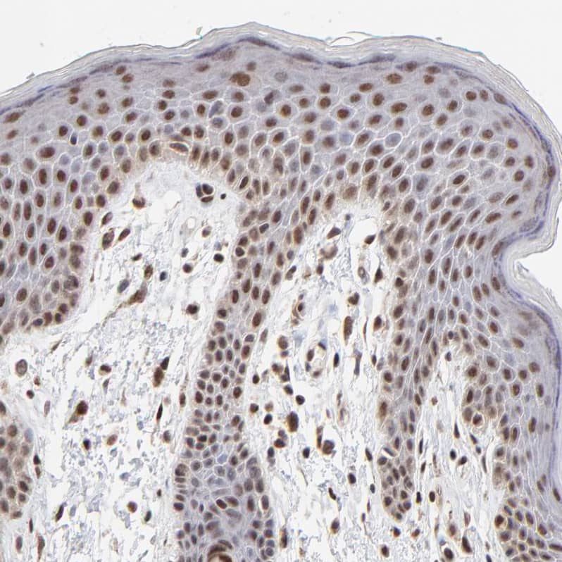 Staining of human skin shows strong nuclear positivity in squamous epithelial cells.