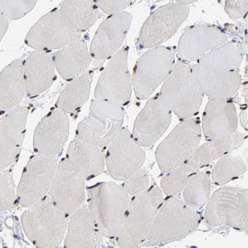 Staining of human skeletal muscle shows strong nuclear positivity in myocytes.