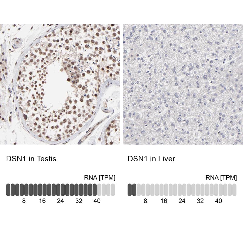 <b>Orthogonal Strategies Validation. </b>Analysis in human testis and liver tissues using HPA002813 antibody. Corresponding DSN1 RNA-seq data are presented for the same tissues.