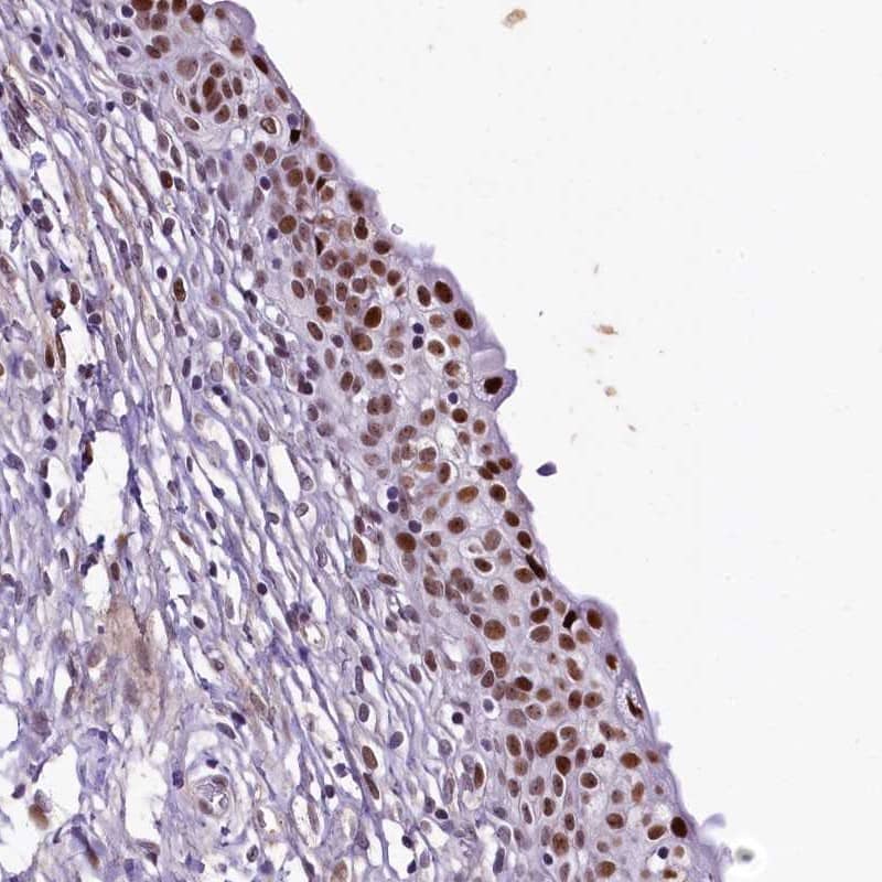 Staining of human urinary bladder shows strong nuclear positivity in urothelial cells.