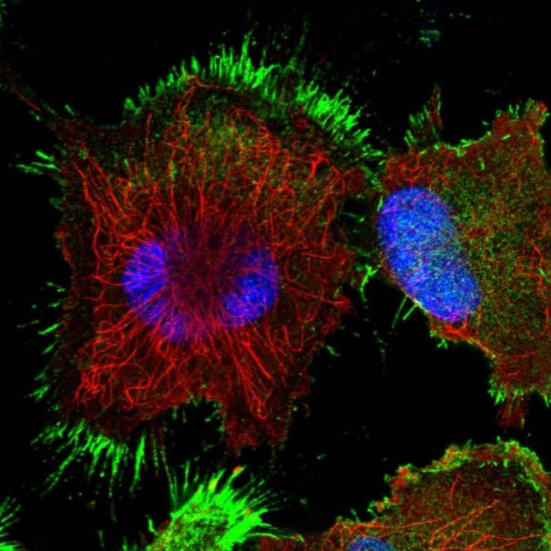 Staining of human cell line U-251 MG shows localization to plasma membrane.