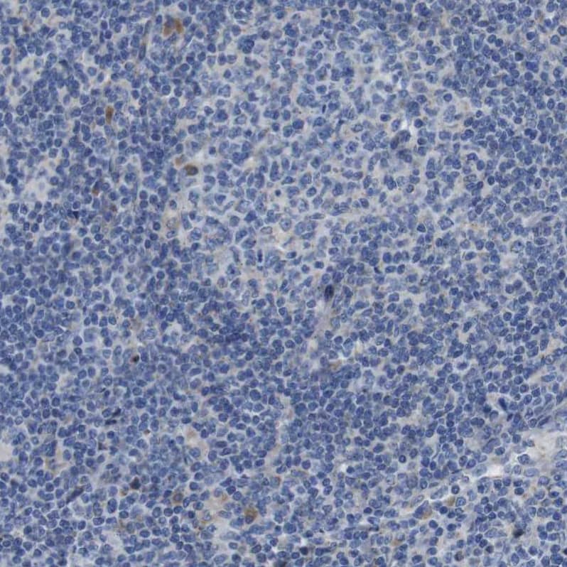 Staining of human lymphoid node shows no cytoplasmic positivity in germinal-center and non-germinal center cells.