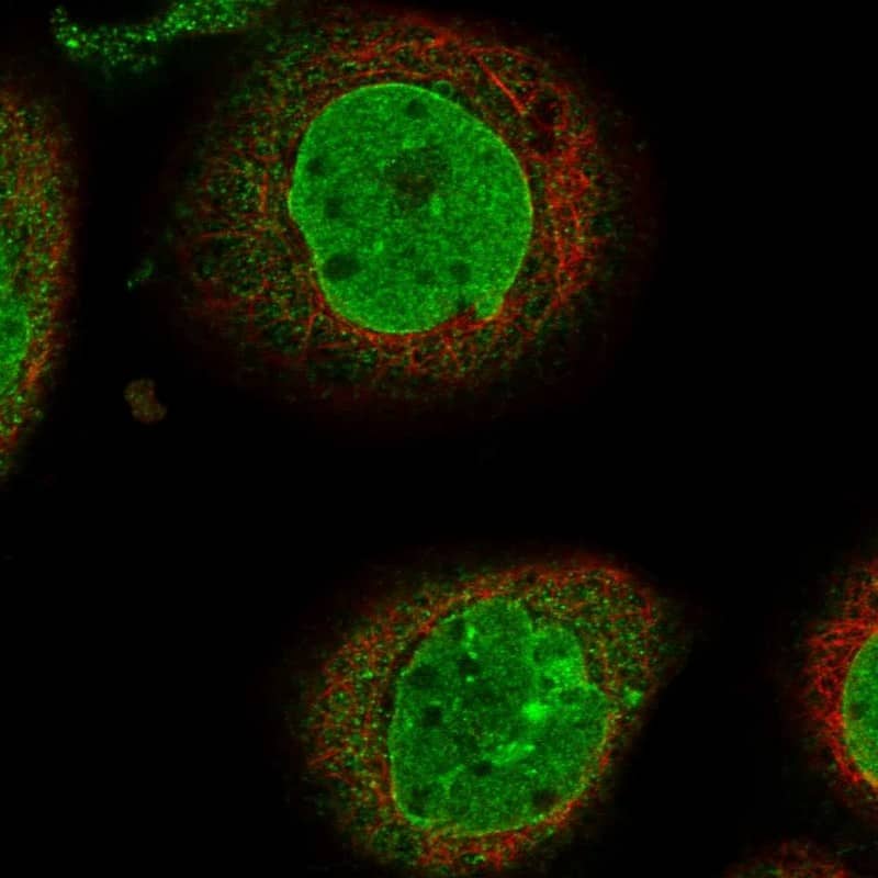 Immunocytochemistry/ Immunofluorescence PHF20 Antibody - BSA Free