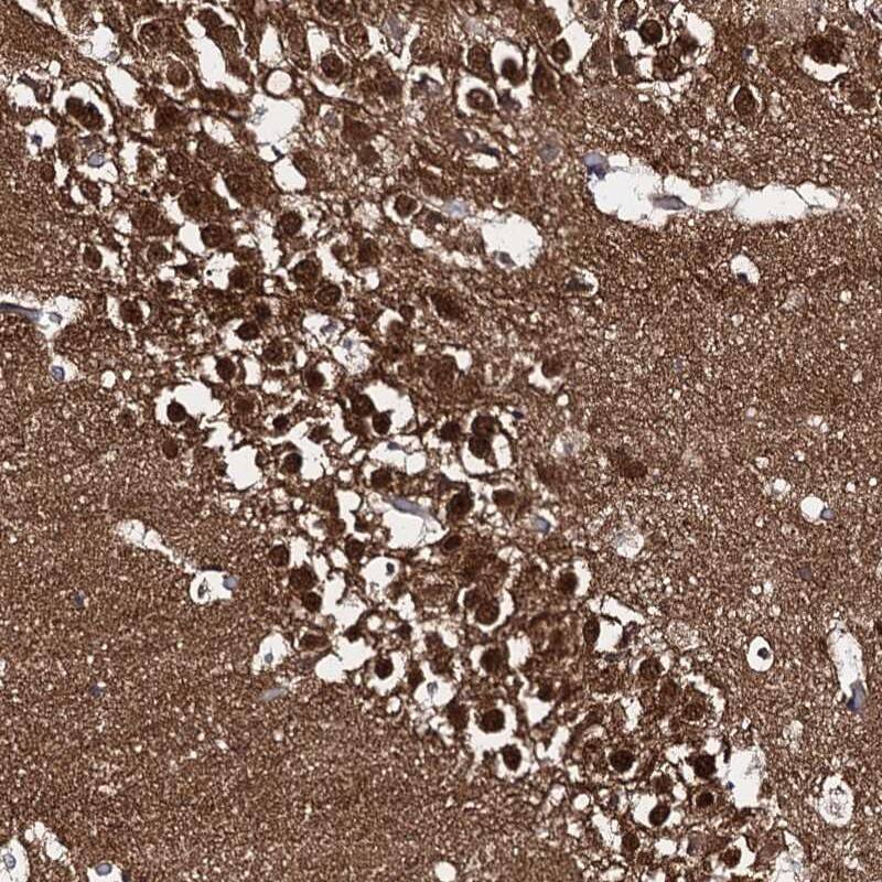 Immunohistochemistry-Paraffin CAPRIN2 Antibody - BSA Free