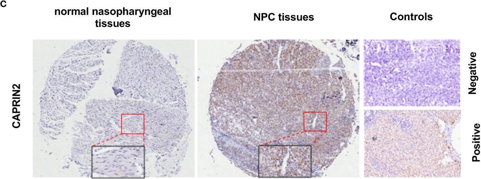 Immunohistochemistry CAPRIN2 Antibody - BSA Free