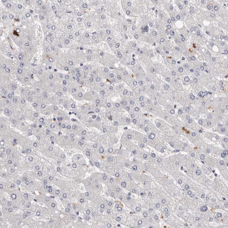 Staining of human liver shows no positivity in hepatocytes as expected.