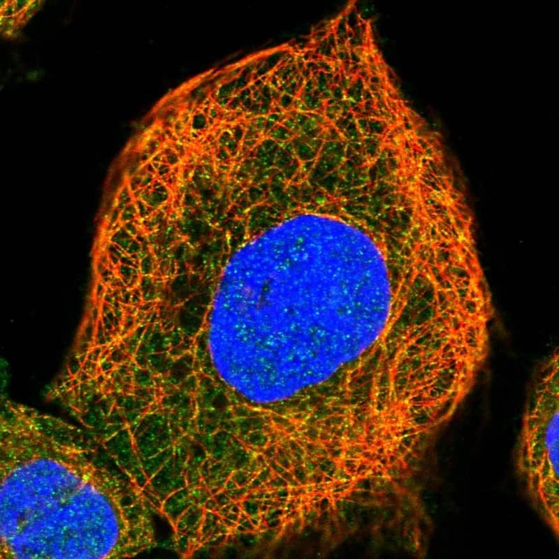 Immunocytochemistry/ Immunofluorescence AIDA Antibody - BSA Free