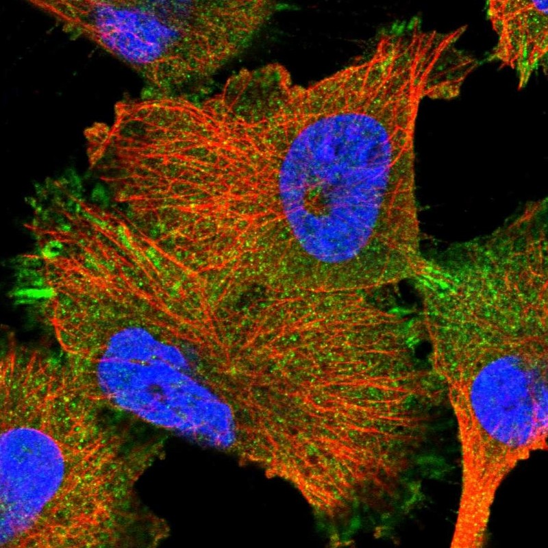 Staining of human cell line U-251 MG shows localization to plasma membrane & focal adhesion sites.