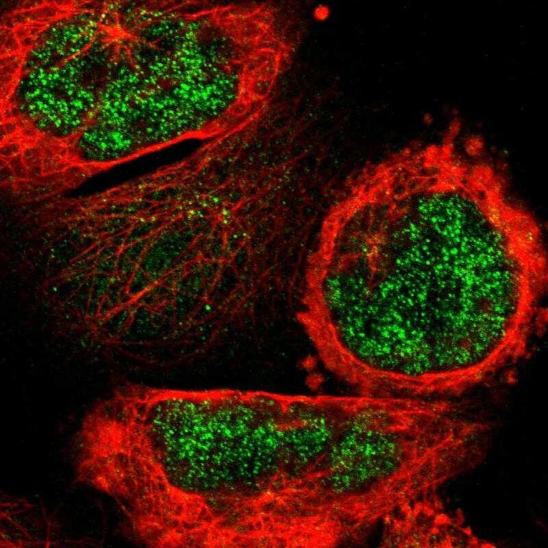 Staining of human cell line A-431 shows localization to nucleoplasm.