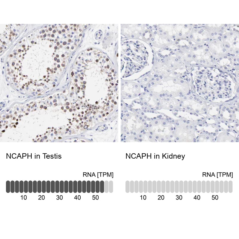 <b>Orthogonal Strategies Validation. </b>Analysis in human testis and kidney tissues. Corresponding RNA-seq data are presented for the same tissues.