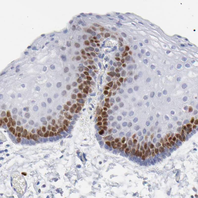 Staining of human skin shows nuclear positivity in epidermal cells.