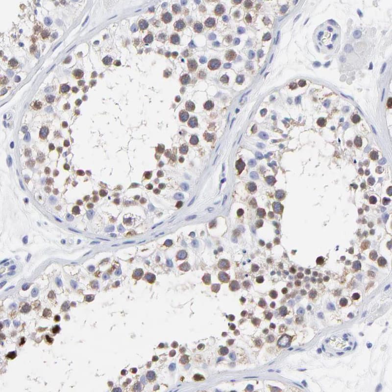 Staining of human testis shows positivity in cells in seminiferous ducts.