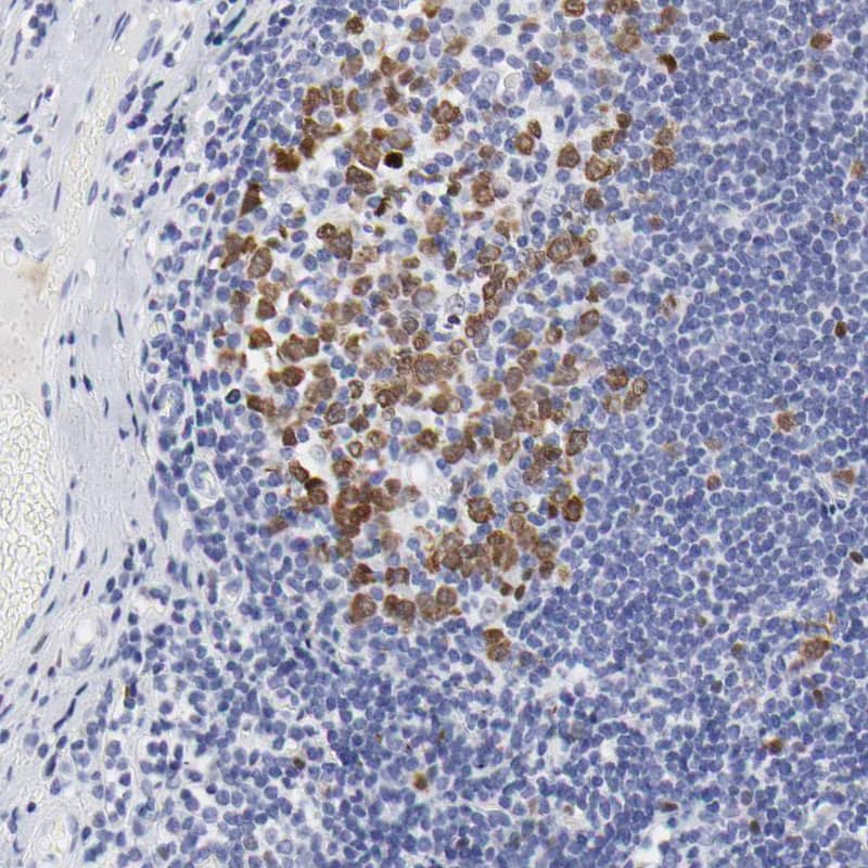 Staining of human tonsil shows nuclear positivity in germinal center cells.