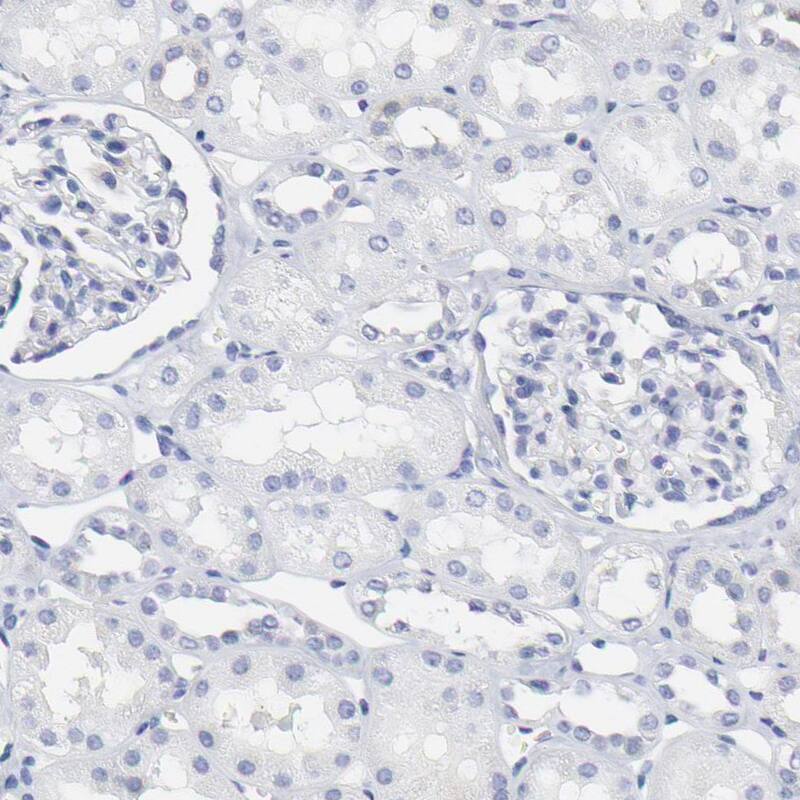 Staining of human kidney shows no positivity as expected.