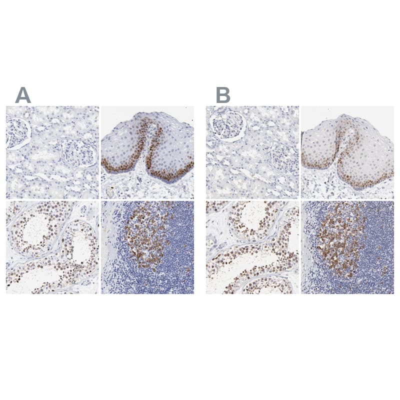 <b>Orthogonal Strategies Validation. </b>Staining of human kidney, skin, testis and tonsil HPA003008 (A) shows similar protein distribution across tissues to independent antibody HPA002647 (B).