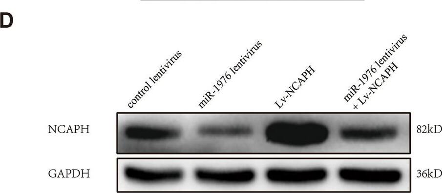 MiR-1976 suppresses tumor growth & metastasis in vivo by targeting NCAPH. A549 cells were infected with the corresponding lentivirus, respectively. About 1 × 107 cells were implanted subcutaneously into nude mice (A), and the tumor volume (B) and weight(C) were observed after cell implantation. NCAPH protein level in xenograft tumor tissues was detected by Western blotting (D, E). In Fig. 7D, the experiments were repeated twice on one membrane (Supplementary information file 2), and Fig. 7D represented one experimental result. The expression of NCAPH, PCNA, and cleaved-caspase-3 in xenograft tumors was detected by IHC staining (F–I). PCNA is a marker of tumor proliferation. A549 cells infected with lentivirus were injected into the tail vein of nude mice (5 in each group) (J). The average number of tumor nodules in each group was calculated (K). HE staining was used to demonstrate tumor nodules (L). * P < 0.05, ** P < 0.01, ***P < 0.001. Image collected and cropped by CiteAb from the following open publication (//www.nature.com/articles/s41598-024-61261-6), licensed under a CC-BY license. Not internally tested by Novus Biologicals.