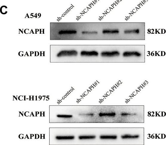 NCAPH promotes proliferation &migration and inhibits apoptosis of LUAD cells. NCAPH overexpression/knockdown lentivirus was used to treat A549 and NCI-H1975 cells. NCAPH proteins were detected by western blot assay (A, C) and quantitative analysis (B, D). The viability of LUAD cells was detected by CCK8 assay (E–H). Transwell assays were performed to detect cell migration (I, J). Apoptosis was measured by flow cytometry (K, L). * P < 0.05, ** P < 0.01, ***P < 0.001. Image collected and cropped by CiteAb from the following open publication (//www.nature.com/articles/s41598-024-61261-6), licensed under a CC-BY license. Not internally tested by Novus Biologicals.