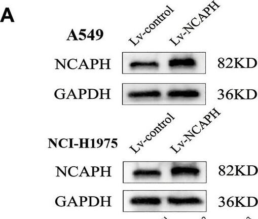 NCAPH promotes proliferation &migration and inhibits apoptosis of LUAD cells. NCAPH overexpression/knockdown lentivirus was used to treat A549 and NCI-H1975 cells. NCAPH proteins were detected by western blot assay (A, C) and quantitative analysis (B, D). The viability of LUAD cells was detected by CCK8 assay (E–H). Transwell assays were performed to detect cell migration (I, J). Apoptosis was measured by flow cytometry (K, L). * P < 0.05, ** P < 0.01, ***P < 0.001. Image collected and cropped by CiteAb from the following open publication (//www.nature.com/articles/s41598-024-61261-6), licensed under a CC-BY license. Not internally tested by Novus Biologicals.