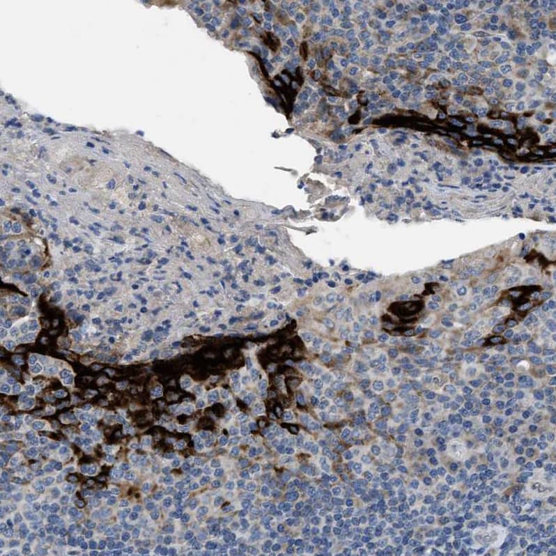 Immunohistochemistry-Paraffin PNKD Antibody - BSA Free
