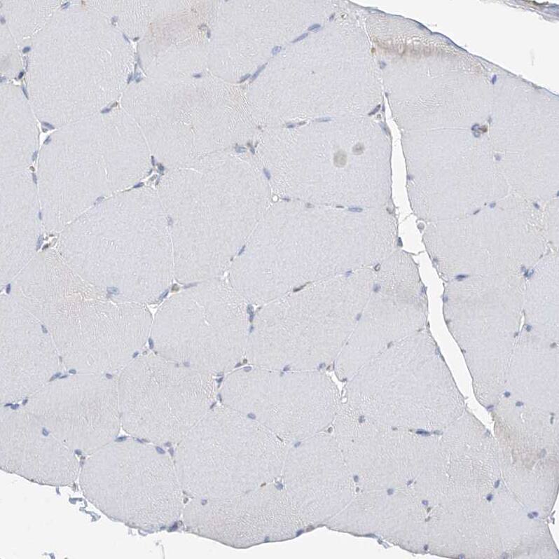 Staining of human skeletal muscle shows no positivity in striated muscle fibers as expected.