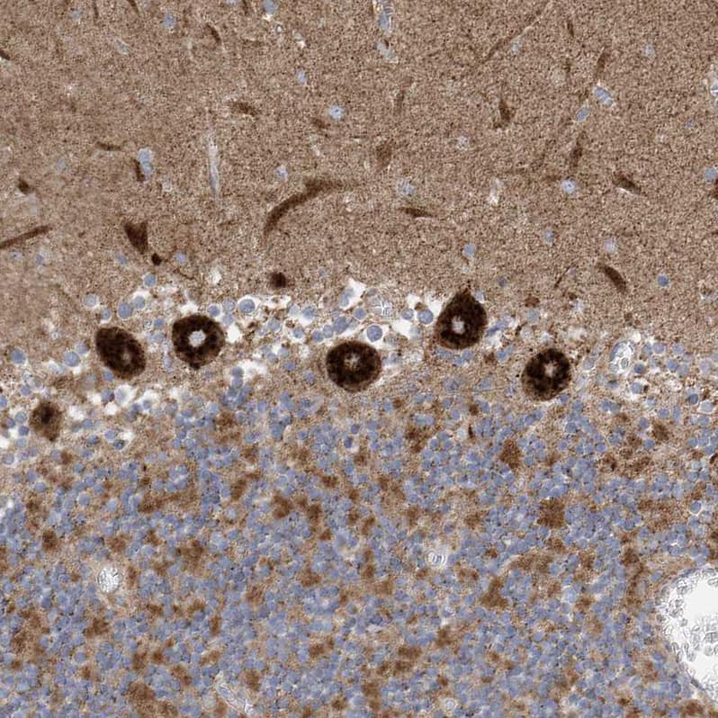 Staining of human cerebellum shows strong cytoplasmic positivity in Purkinje cells.