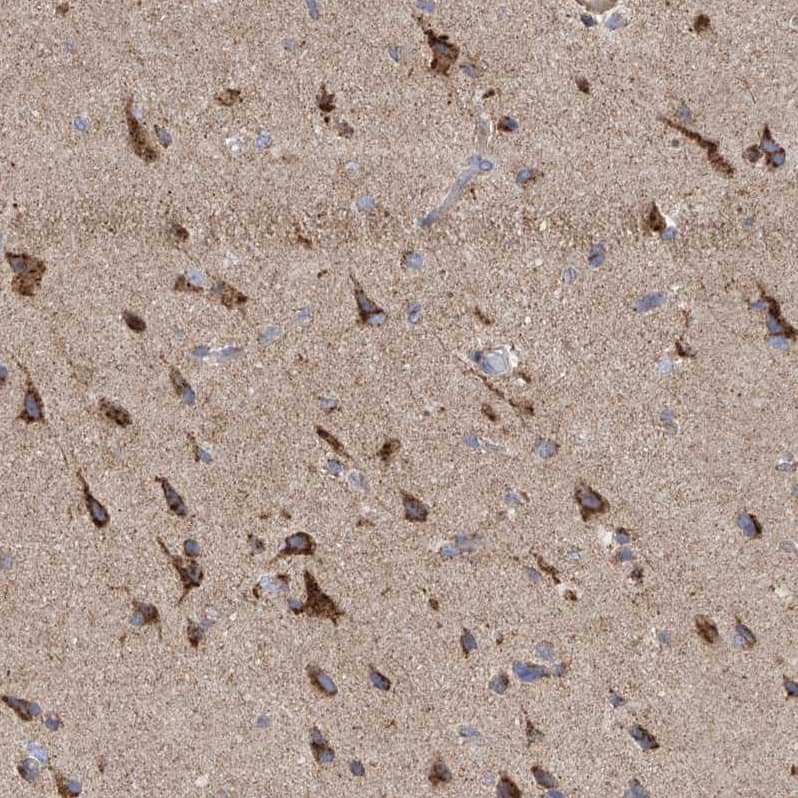 Staining of human cerebral cortex shows strong granular cytoplasmic positivity in neuronal cells.