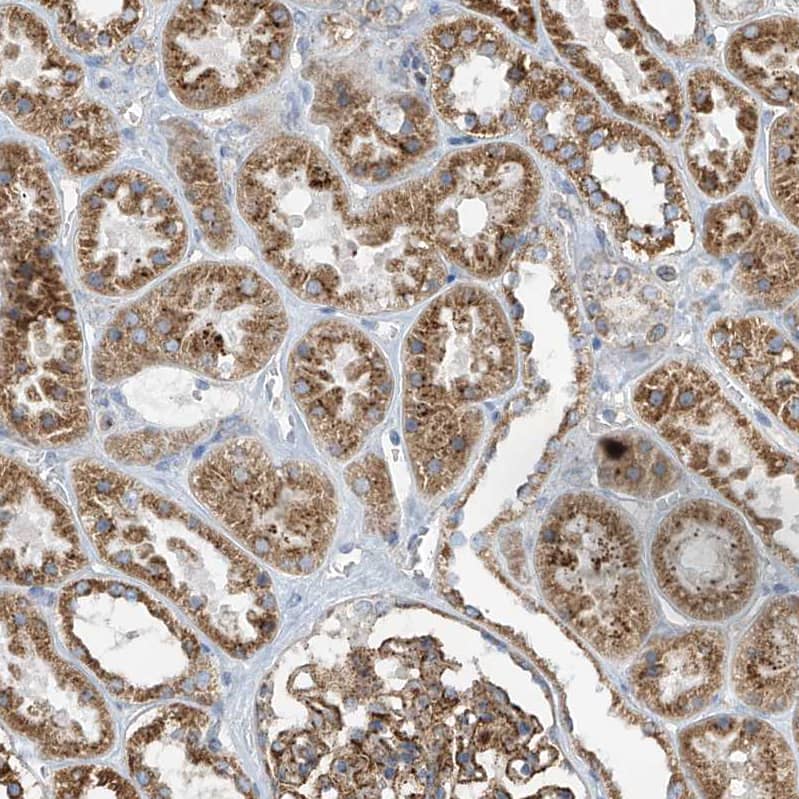 Staining of human kidney shows moderate granular cytoplasmic positivity in cells in tubules.