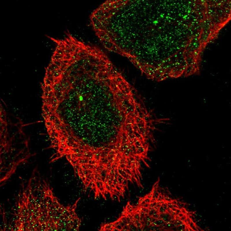 Staining of human cell line A-431 shows localization to cytosol & centrosome.