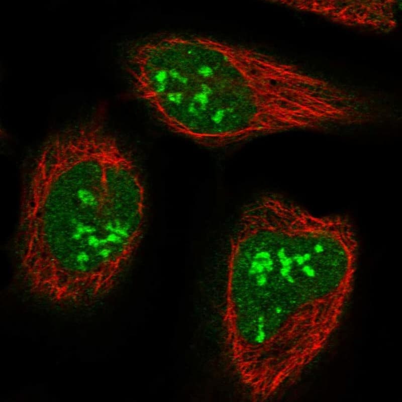 Staining of human cell line U-2 OS shows localization to nucleus & nucleoli.