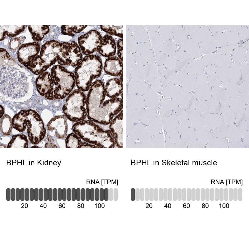<b>Orthogonal Strategies Validation. </b>Analysis in human kidney and skeletal muscle tissues.